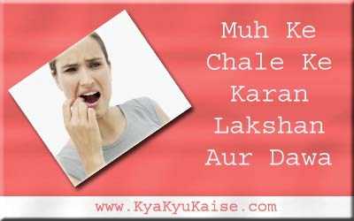 मुंह के छाले की दवा का नाम लक्षण और कारण - Muh Ke Chale In Hindi