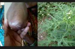 Airborne Contact Dermatitis Homeopathic Treatment Success Story