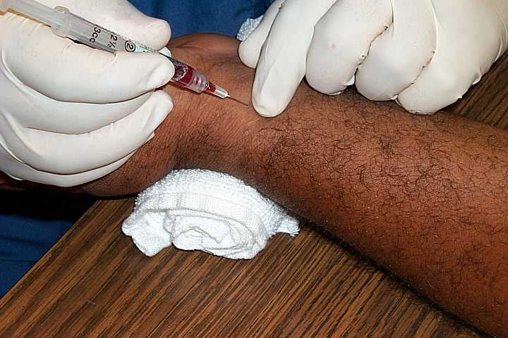 Arterial Blood Gas - ABG Analysis In 3 Steps