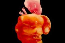 GIVE THEM SOME SUNSHINE!