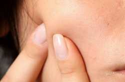 How to Get Rid of Acne: Best Food to Eat » Healthilicious Plate