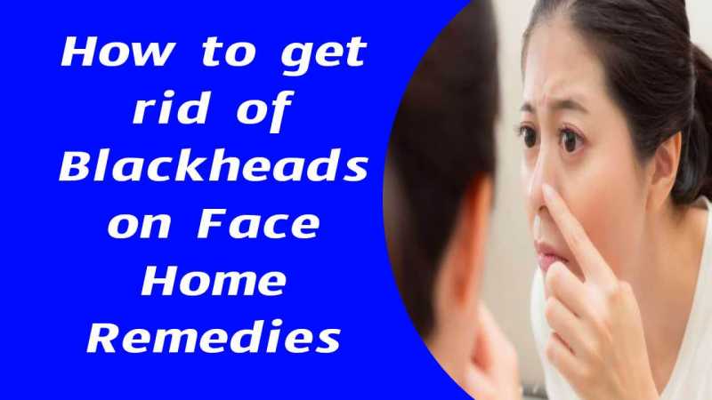 How To Get Rid Of Blackheads On Face Home Remedies