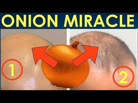 How To Use Onion Juice To Stop Hair Loss And Promote Hair Regrowth - Grow Beautiful Hair