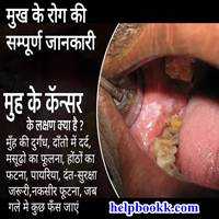 Muh Ke Cancer Ka Ilaj In Hindi | मुँह के रोग की संपूर्ण जानकारी - HelpBookk.Com