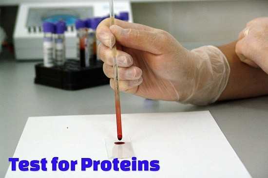 Test For Proteins | Chemical Methods Of Identification In Labs