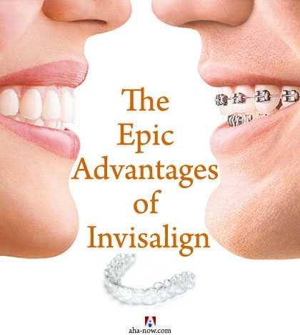 The Epic Advantages Of Invisalign