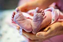 What is Down syndrome? - Wealth with Wellness