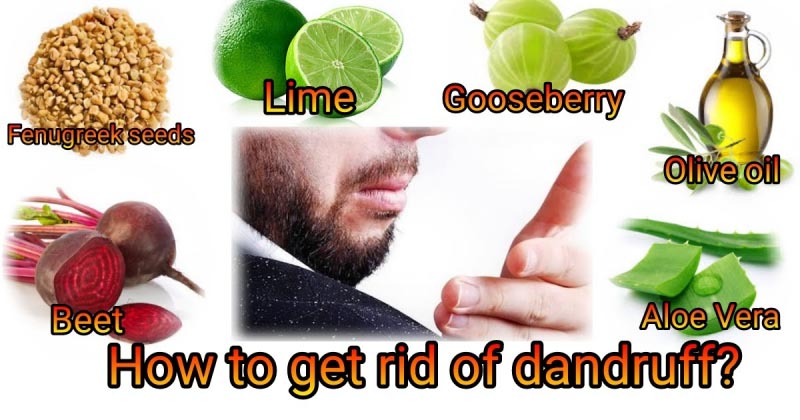 What Is Dandruff? Causes, Treatments, And Precautions